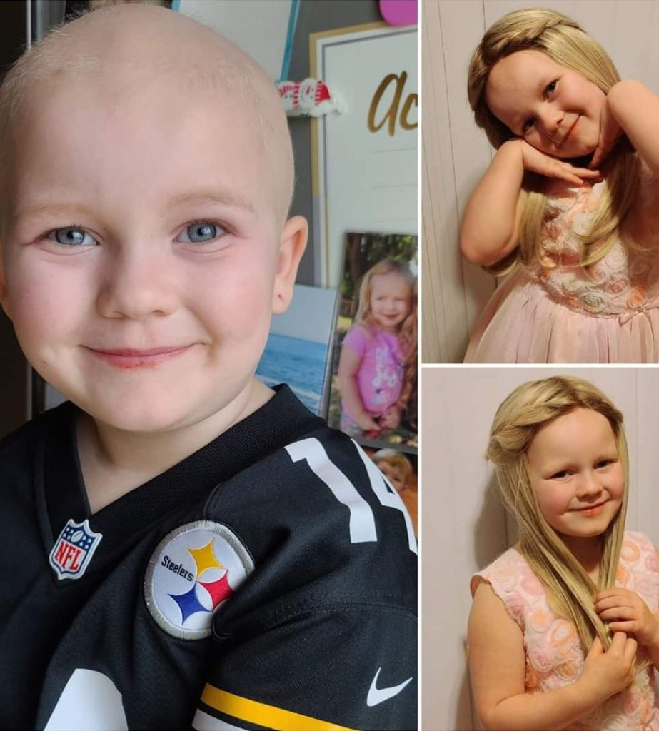 Hair Donation Children With Hair Loss Donations